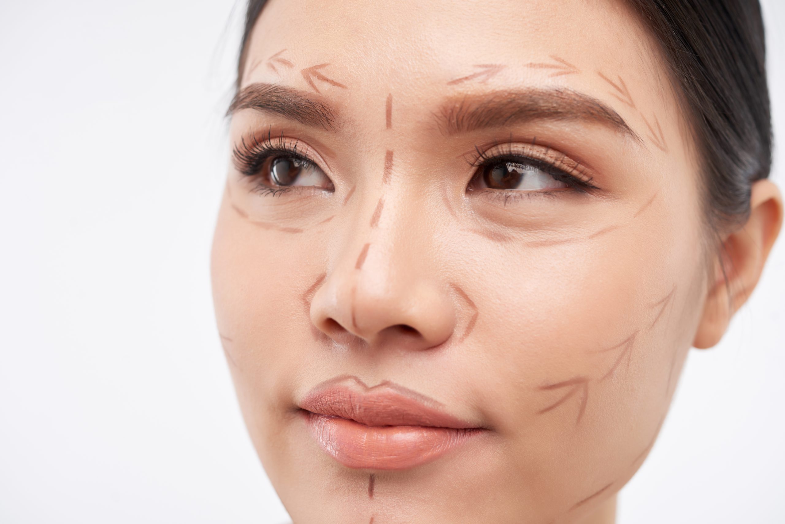 Thread Lift Conshohocken PA | Non-Surgical Lift