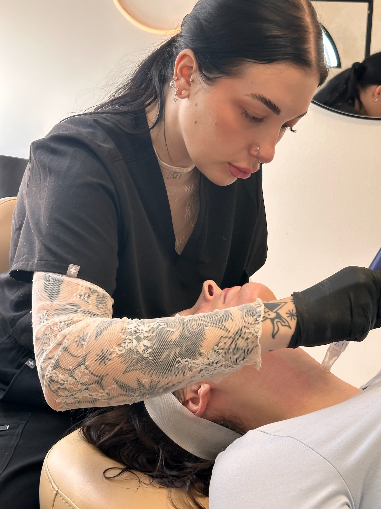 microneedling (2)