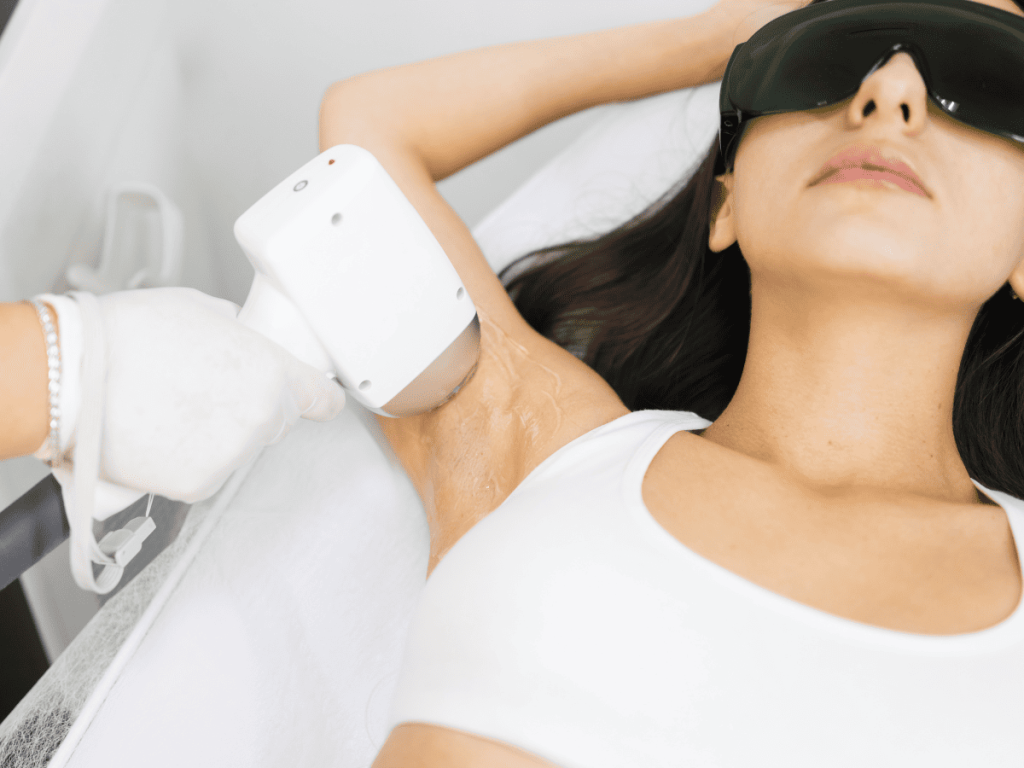 Laser hair removal treatment in Conshohocken at Forte Faces using advanced technology for safe and effective long-term hair reduction.